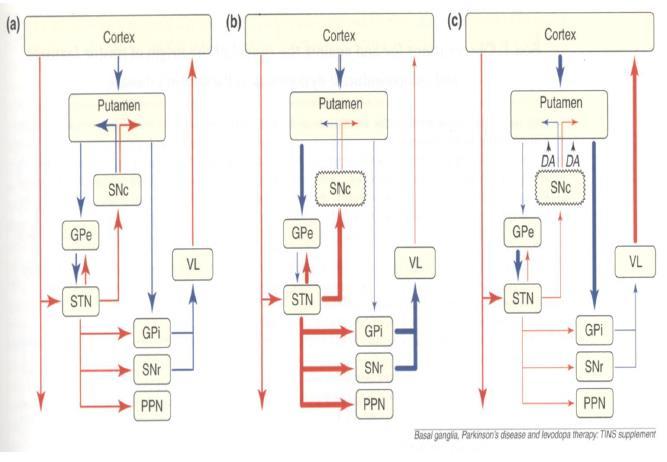 Εικόνα 20: Σχηματική αναπαράσταση του μοντέλου των βασικών γαγγλίων στη φυσιολογική (a), η παρκινσονική (b) και η δυσκινητική (c) κατάσταση Τα μπλε βέλη αντιπροσωπεύουν τις ανασταλτικές προβολές ενώ