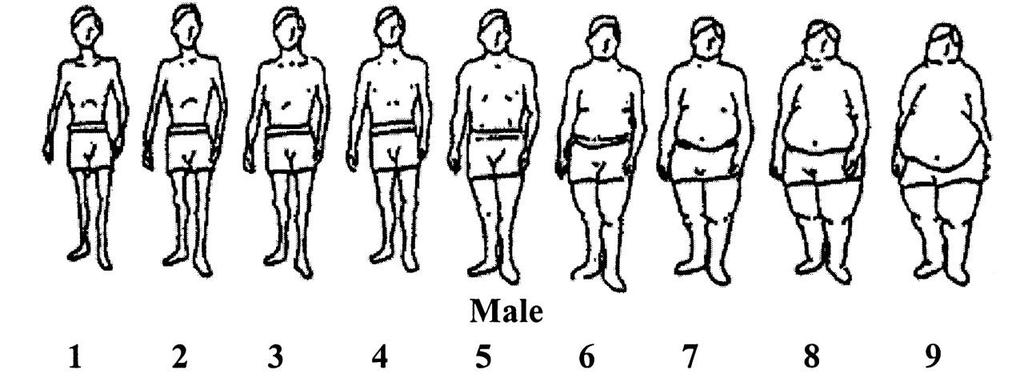 Εικόνα 1: Εικόνα σώματος και μέση τιμή ΔΜΣ για άνδρες με ή χωρίς ΣΔτ2 ΣΔ2 ΔΜΣ : 20,1 23,9