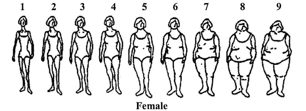 Εικόνα 2 : Εικόνα σώματος και μέση τιμή ΔΜΣ για γυναίκες με ή χωρίς ΣΔτ2 ΣΔ2 ΔΜΣ : 18,5 29,7 25,3* 33,5 40,7 SD 4,7