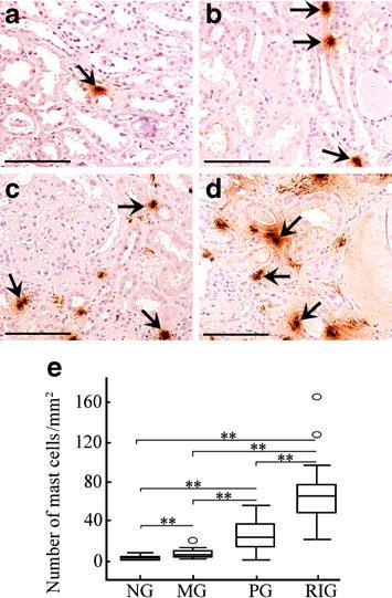 Pathogenic role of mast cells in the development of