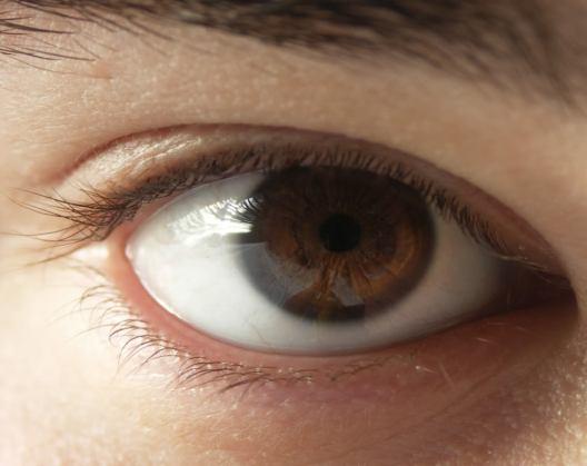 Μάτια Καστανά Τα καστανά μάτια οφείλουν το χρώμα τους στην πυκνή επίστρωση μελανίνης που υπάρχει στο βυθό της ίριδας.