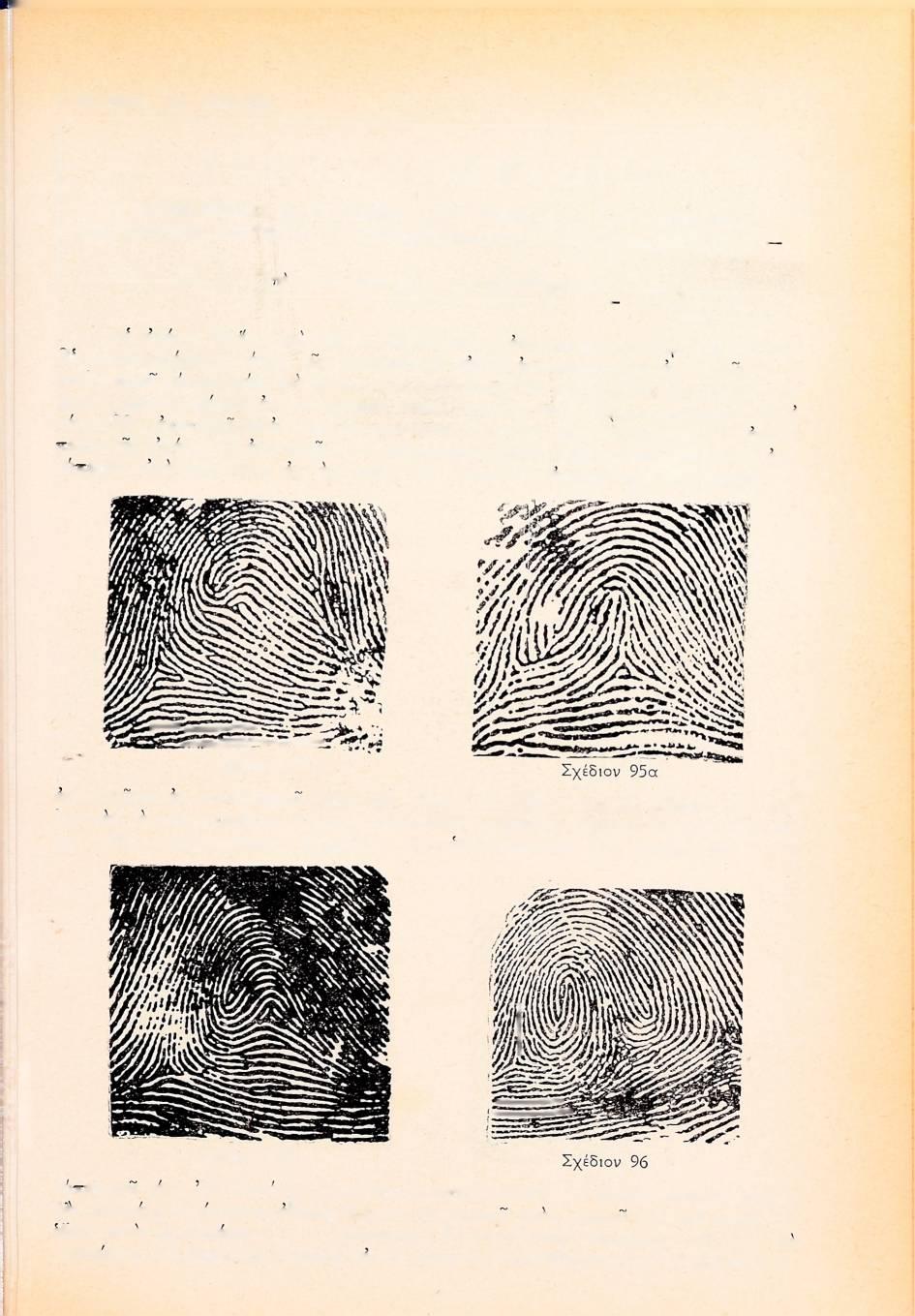 ΤΕΧΝΙΚΗ ΑΣΤΥΝΟΜΙΑ ΔΑΚΤΥΛΟΣΚΟΠΙΑ -ΤΑΞΙΝΟΜΠΣίΣ ΔΑΚΤΥΛΙΚΩΝ ΑΠΟΤΥΠΩΜΑΤΩΝ ΚΑΤΑ ΜΕΘΟΔΟΝ ΕΔ. ΧΟΥΒΕΡ, ΔΙΕΥΘΥΝΤΟΥ ΟΜΟΣΠΟΝΔΙΑΚΗΣ ΑΣΤΥΝ. Β. ΑΜΕΡΙΚΗΣ Ύ-ΓΟ Αστυνόμου Β' κ. Δ. ΚΑΤΣΙΜΑΓΚΛΗ (Συνέχεια έκ τοϋ προηγουμένου), At εικόνες 95 εως και 95β δεικνύουν τύπους αποτυπωμάτων γόος «άξιτένταλ».