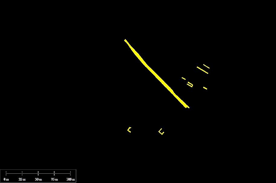 Analysis (PCA) REIP (band 2) Gamma