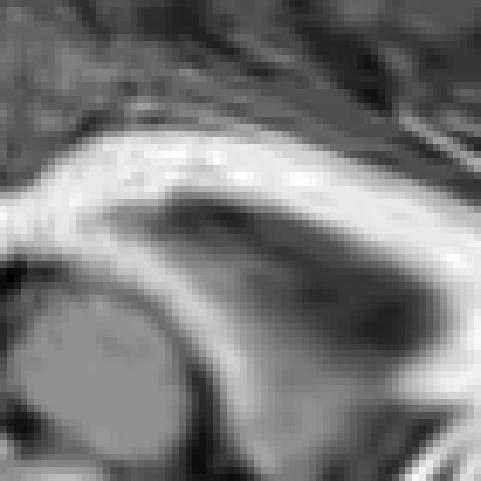 Fgure 6: 2D regstraton of MRI slces, (a-b) fxed mage, (c-d) movng mage, red