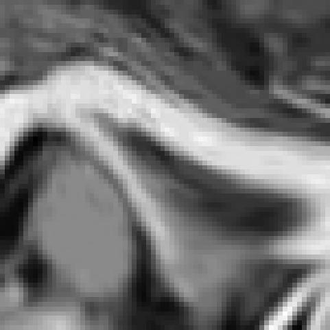 Wt 9 2nd order et-partcles (3 per axs), te movng mage approaces te fxed.