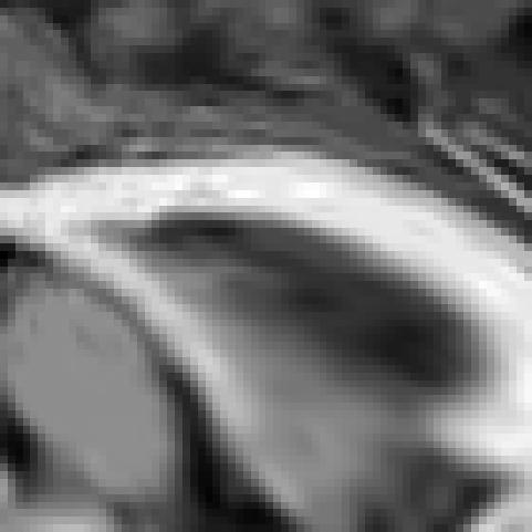 Te ventrcle regon can equvalently be nflated wt 64 t order et-partcles. 8.