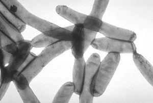 Είκοσι οκτώ από τα 48 είδη Legionella έχουν συνδεθεί με τους ασθενείς με πνευμονία (2).
