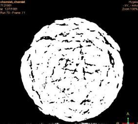 XRay CT