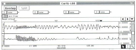 Funcția respiratorie 69 Se setează lungimea înregistrării: se selectează File > Preferences, apoi se setează la 5 minute (300 secunde).