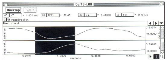 70 Lucrări practice de fiziologie Parametrii folosiţi ( zona selectată este zona selectată de unealta de selecţie a softului inclusiv punctele finale): Delta T: diferenţa în timp dintre începutul şi