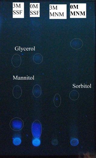 ب) 3M 0M 3M 0M 3M 0M Sorbitol 3M 0M 3M 0M SSF SSF MNM MNM