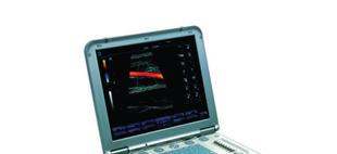 Performanțã de înaltã calitate Pentru a asigura o calitate excelentă imaginii şi pentru o diagnosticare performantã, M5 integreazã o serie de tehnologii imagistice avansate.