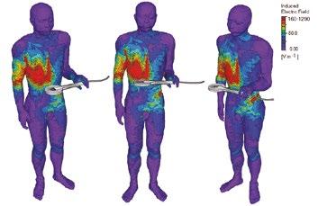 Tāda inducētā elektriskā lauka sadalījums cilvēka modelī, ko rada eksponētība TMS spolei, turot spoli 15 cm attālumā no ķermeņa Inducētais elektriskais lauks 160 1290 80,0 0,00 [V m -1 ] Komanda