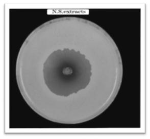 115 ÊÉãdG Aõ G IÉ«لهG Yhلƒم Ö dg Figure-4 Inhibition zone produced by alkaloids