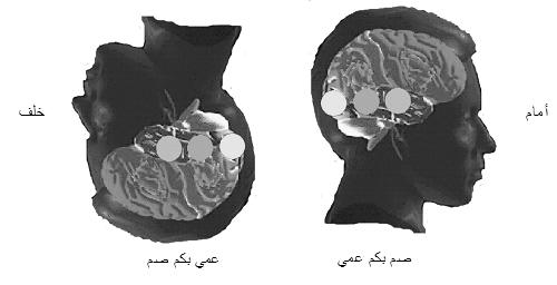 174 المؤتمر العالمي العاشر لإلعجاز العلمي في القرآن والسنة (4) ùµ æj ó شûe áä«dg IôNB G ÚHò ŸG SÉµàfG لرتسيخ اخلزي واملخالفة للخلقة السوية بمشهد حيس بلغ االنتكاس فيه الغاية والعجيب املذهل أن ينعكس
