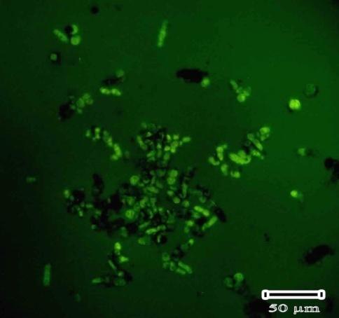 821 نتايج سلولهاي زنده و فعال قارچي با دو رنگ Cal AM وFDA رنگ سبز روشن فلورسانس را به نمايش گذاشتند در حالي كه سلولهاي مرده رنگ نشدند يا به عبارتي در اين موارد تصوير كاملا سياهي از نمونه ها به دست