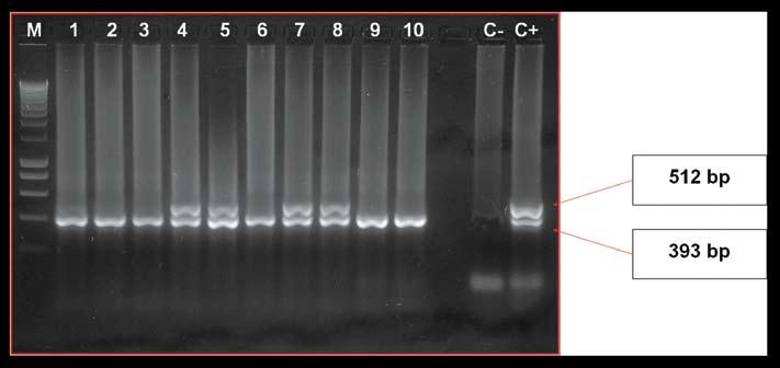 Table 1. Results of ELISA and PCR of the blood samples of investigated local goats in Syria. Results of PCR and ELISA (n) (%) ELISA PCR PCR and ELISA Positive 47 19.34 Negative 196 80.