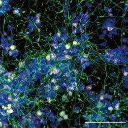 Figure 9. Differentiation of pla-ipscs into dopamine neurons.