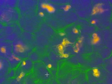 Fluorescenčna mikrospektroskopija (FMS) - lokalizacija molekularnih