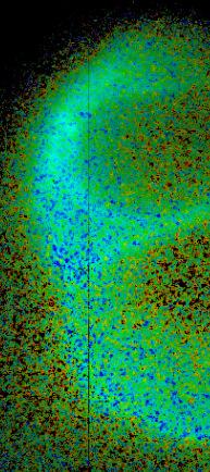 zlivanja membrane liposomov s