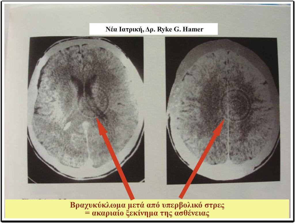 3) Το οντογενετικό σύστημα των ασθενειών - Ο τρόπος εμπέμβασης του εγκεφάλου στο όργανο που επιλέγεται σαν στόχος του εξαρτάται απο την εμβυολογική προέλευση του οργάνου.