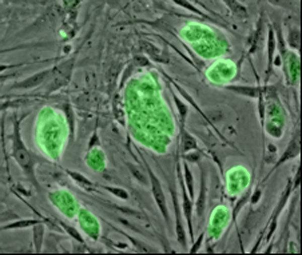 Πολυδύναμα βλαστικά κύτταρα ανθρώπου (human Pluripotent Stem Cells hpscs)