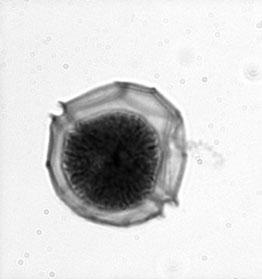 Alge: Dinophyta: ognjene alge 1 klorofila a (c), β-karoten, peridinin idr. (dinoficejski?