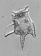 sekundarni; fosili znani od jure dalje, vodilni mikrofosili Noctiluca Plasmodium Alge: