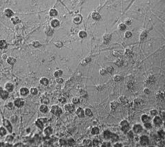 Alge: Chlorarachniophyta klorofil a, b paramilum?