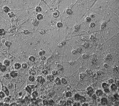 Alge: Chlorarachniophyta klorofil a, b paramilum?