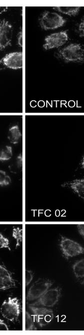 Η ανάλυση Western Blot πρωτεϊνικών εκχυλισμάτων