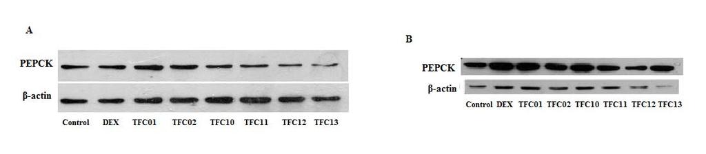 Εικόνα 24: Αποτελέσματα των αναλύσεων Western Blot για το ένζυμο καρβοξυκινάση του φωσφοενολοπυροσταφυλικού (PEPCK) στις καρκινικές σειρές HeLa (A) και HepG2 (Β).