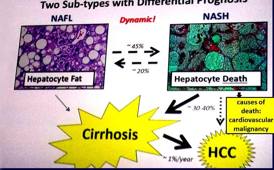 metabolického syndrómu (MS). 33 44 % dospelej populácie EÚ má NAFLD. To už je nielen zdravotnícky, ale aj celospoločenský problém. MS je systémové ochorenie.