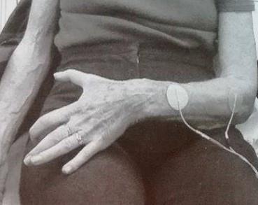 Υπάρχουν μελέτες που υποδεικνύουν οφέλη στη χρήση FES, ωστόσο χρειάζεται περεταίρω διερεύνηση καθώς δεν θεωρείται ότι θα έχει σίγουρα οφέλη.