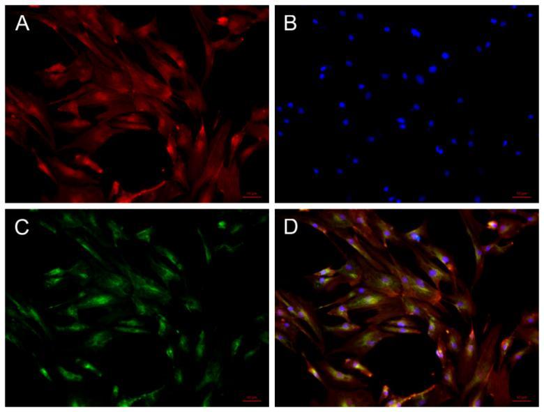 Expresia proteinei fosfatază alcalină a fost de asemenea investigată prin colorarea imunocitochimică a celulelor OBL tratate cu 100 µg/ml AuNPs@gelatină. Tripla colorare (Figura 4.