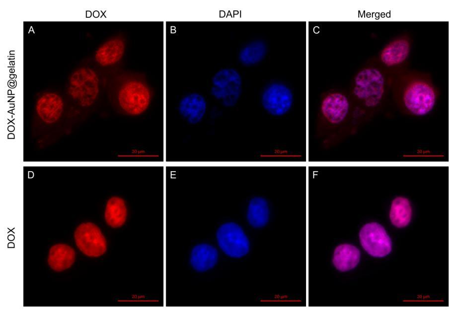 Microscopia de fluorescenţă evidenţiază diferențe remarcabile în tiparul internalizării DOX libere sau încărcată pe AuNPs@gelatină, așa cum se poate vedea comparând Figura 5.5 A, B, C și Figura 5.