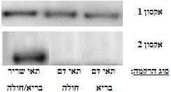 בשלב הראשון- החוקרים הפיקו RNA מתאי החולה )תאי דם לבנים מאדם בריא, תאי דם לבנים מהאדם החולה, תאי עור ותאי שריר הן מאדם חולה והן מאדם בריא( וביצעו אנליזת northern blot עם גלאי ספציפי לגן.