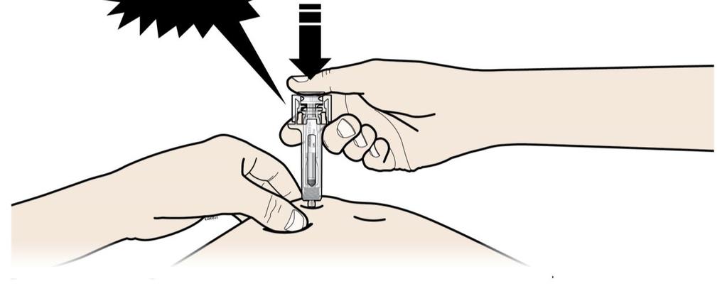 B ÝTIÐ stimplinum með hægum og jöfnum þrýstingi þar til þið finnið fyrir eða heyrið smell.