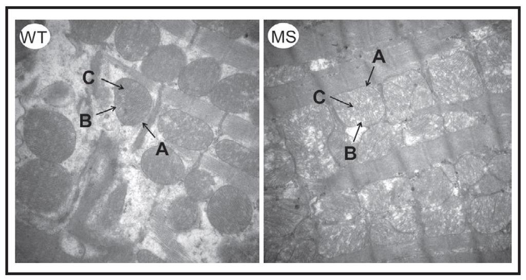 Cell Physiol Biochem 2017;43:959-968 Ελάττωςθ τθσ