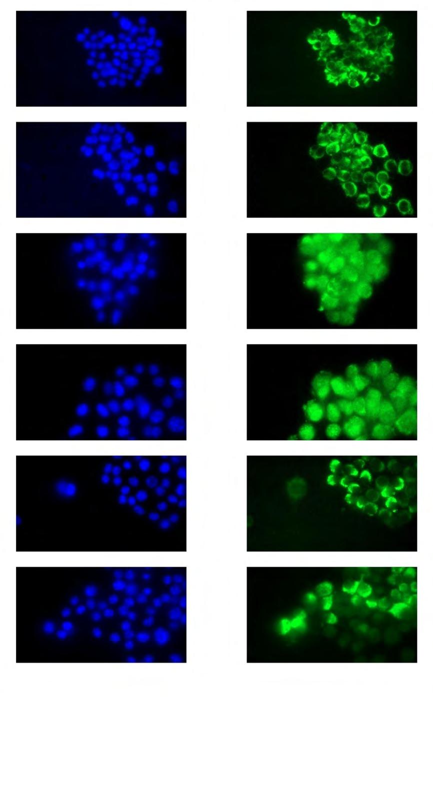 Hoechst GFP mtgfp 16 mtgfp 19 GFPERβ