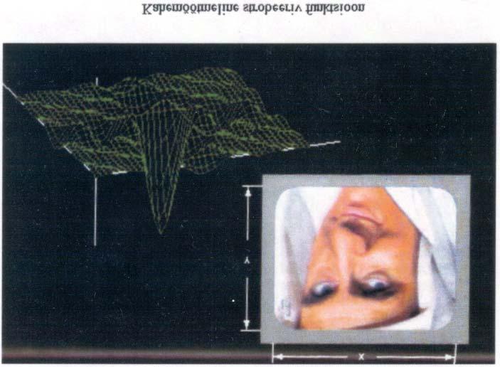 ξ, η - ruumilised koordinaadid, seotud kaalufunktsiooni
