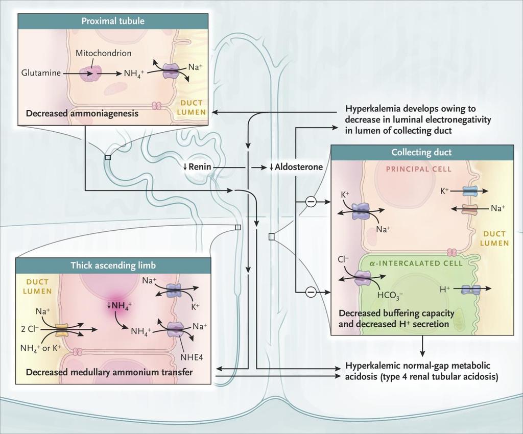 Παθογένεση των ηλεκτρολυτικών διαταραχών σε RTA τύπου 4 (νεφρική