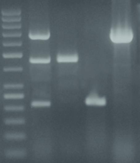 σε σύστημα SDS-PAGE χρησιμοποιείται για τον υπολογισμό του ΜΒ και της σχετικής ποσότητας (αφθονία) πρωτεϊνικών μορίων σε ένα δείγμα, αλλά και για τον καθορισμό της κατανομής πρωτεϊνών σε διάφορα