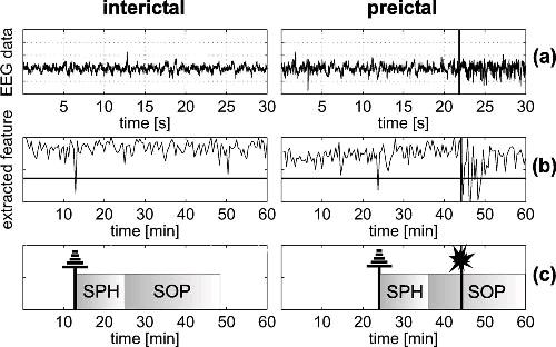 Παράδειγμα: Πρόβλεψη επιληπτικών κρίσεων Πρόβλεψη με βάση το ηλεκτροεγκεφαλογράφημα (EEG) Επιλογή χα