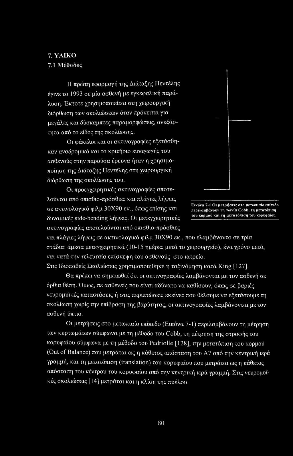 Οι φάκελοι και οι ακτινογραφίες εξετάσθηκαν αναδρομικά και το κριτήριο εισαγωγής του ασθενούς στην παρούσα έρευνα ήταν η χρησιμοποίηση της Διάταξης Πεντέλης στη χειρουργική διόρθωση της σκολίωσης του.