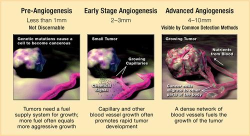 Μηχανισμός αγγειογένεσης Η διαδικασία της αγγειογένεσης σε καρκινικές καταστάσεις διακρίνεται σε 3 φάσεις : 1. στην έναρξη ( initiation ) 2.