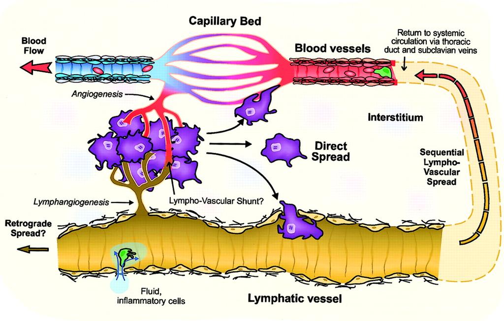 Εικόνα 47. Lymphatic vessel structure and potential modes of tumor cell dissemination.