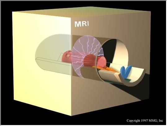 Magnetic Resonance Imaging Aπεικόνιση Μαγνητικού Συντονισµού Σύµπλοκα του γαδοληνίου Gd +3 O O O O -O N N N O Gd O O O O Magnetic Resonance Imaging Σκιαγραφικά Αλλάζουν τον