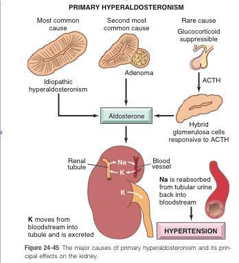 HIPOPOTASEMIA Pierderi renale excesive de K pe cale renală Hiperaldosteronismul primar 1.
