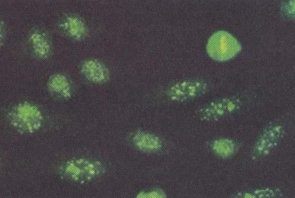 ΑNA-Κεντρομεριδιακός φθορισμός (κύτταρα HEp2) (ο αρ. των κοκκίων αντιστοιχεί στον αρ.